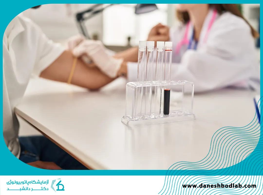 آزمایش هورمونی در شیراز | تفسیر کامل آزمایش هورمونی زنان و مردان