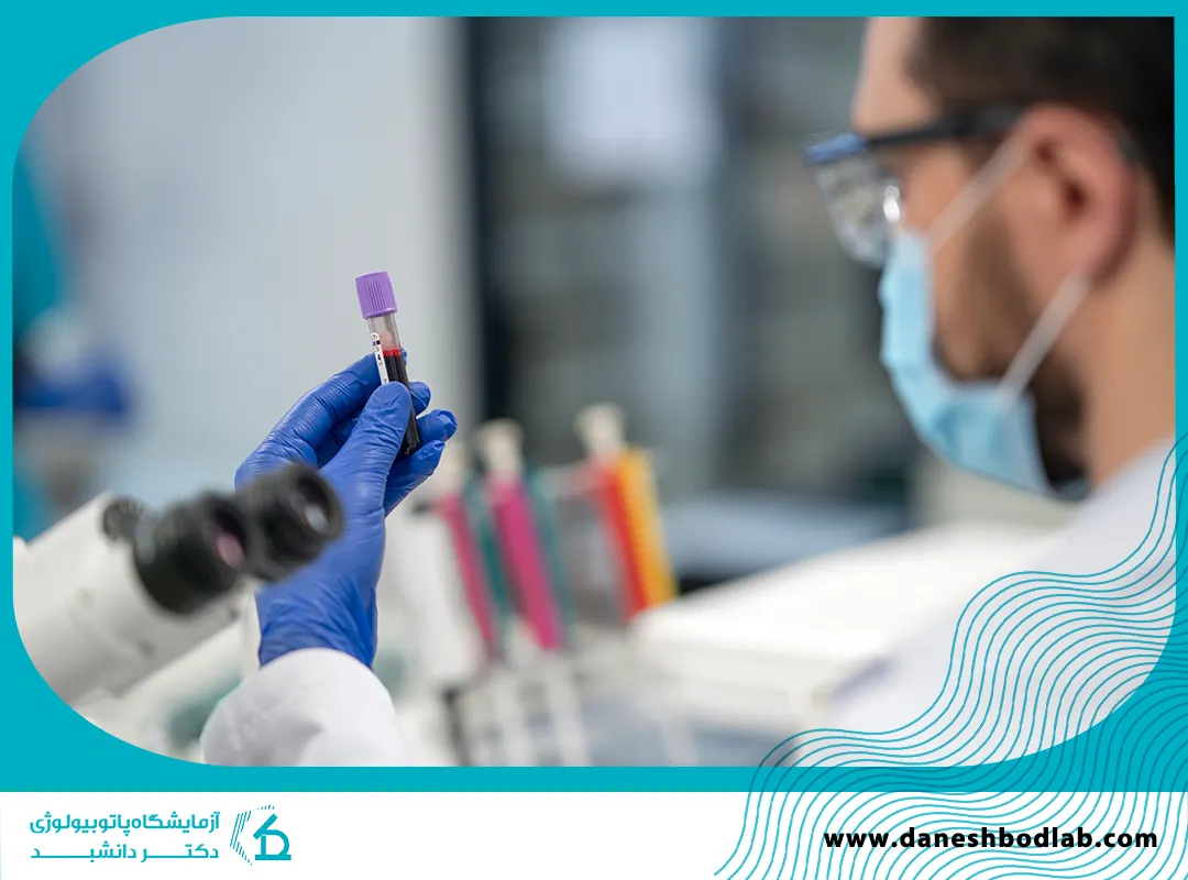آزمایش تومور مارکر در شیراز | تفسیر، رنج نرمال در تشخیص سرطان
