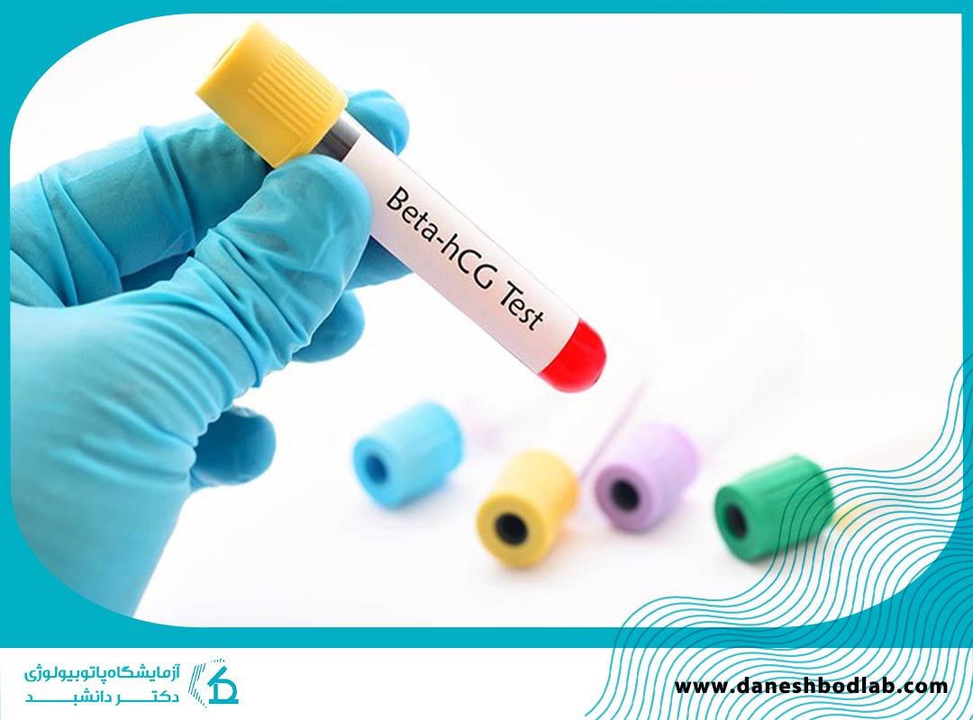 آزمایش خون بارداری