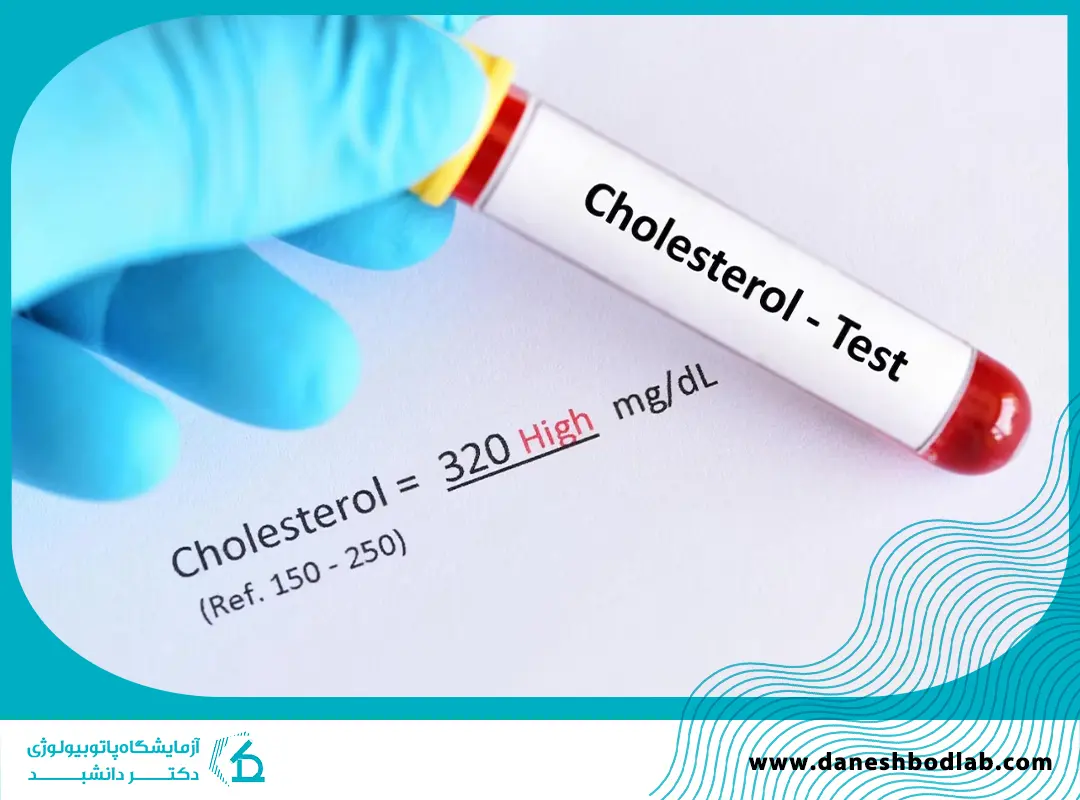 کلسترول در آزمایش خون؛ نشانهها، تفسیر نتایج