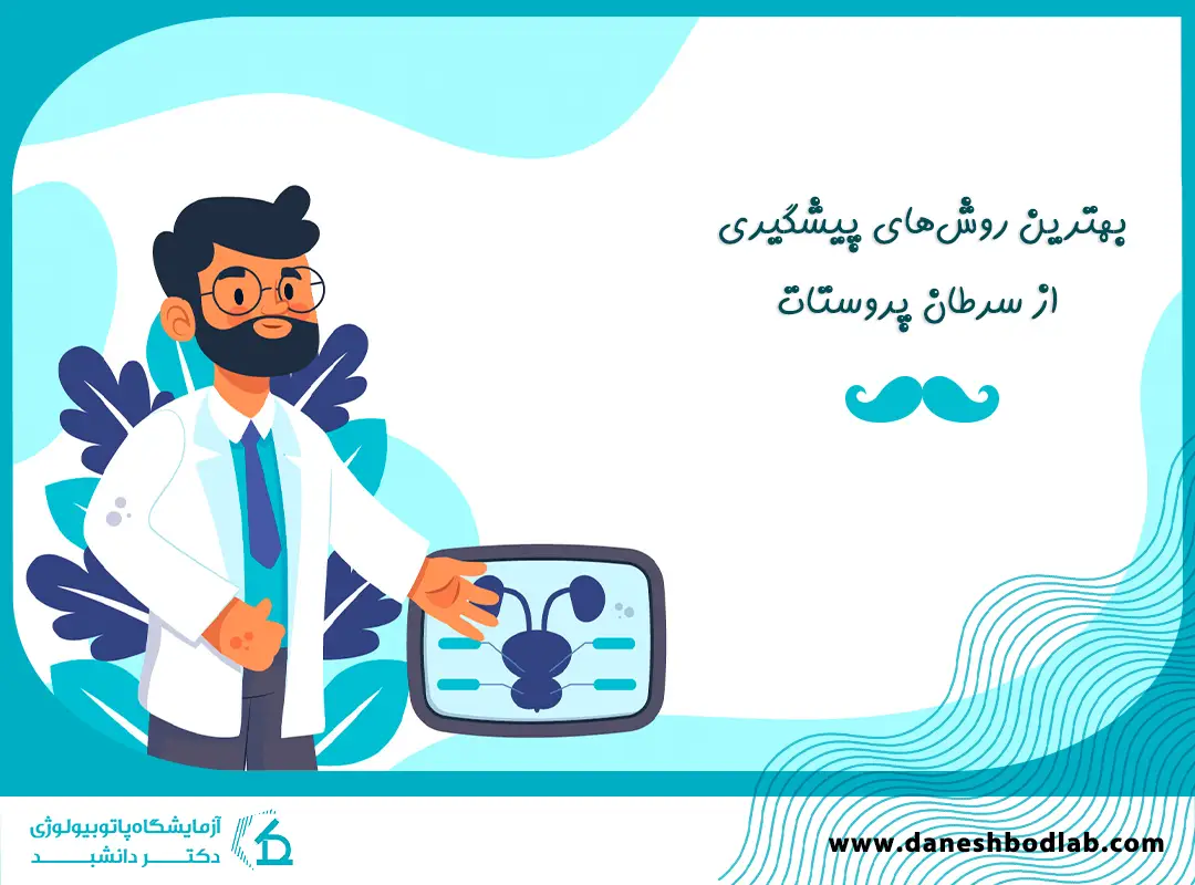 روش های پیشگیری از سرطان پروستات