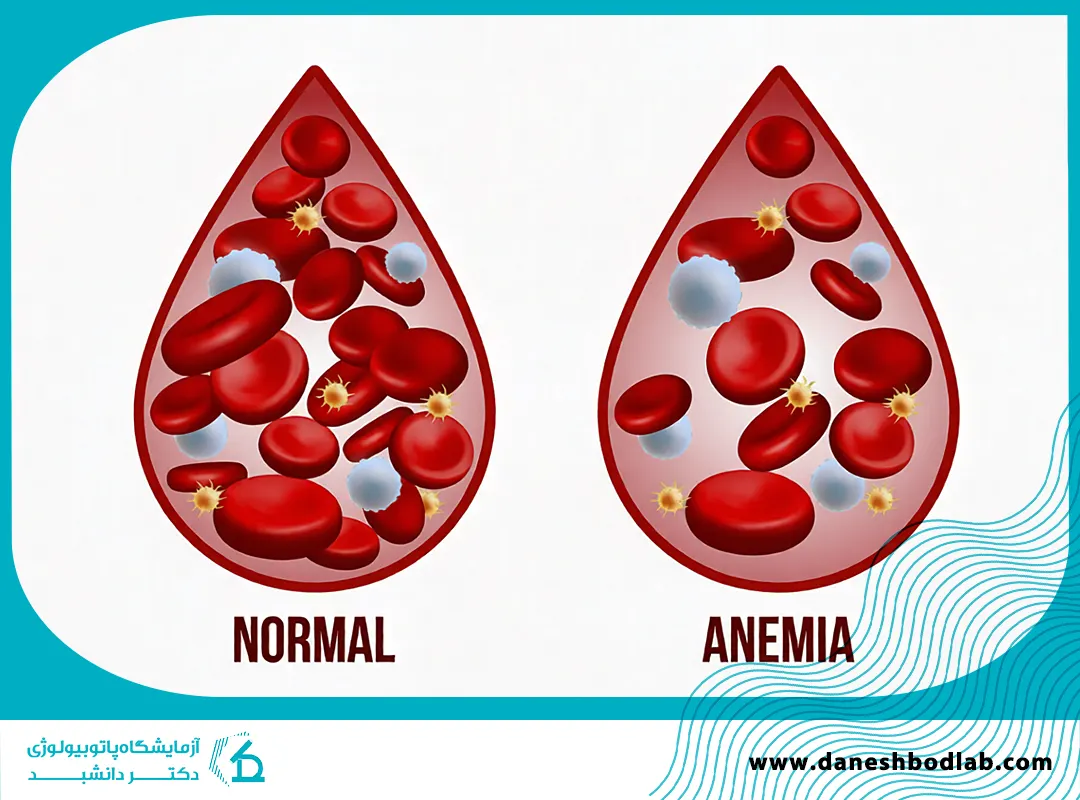 آزمایش کم خونی