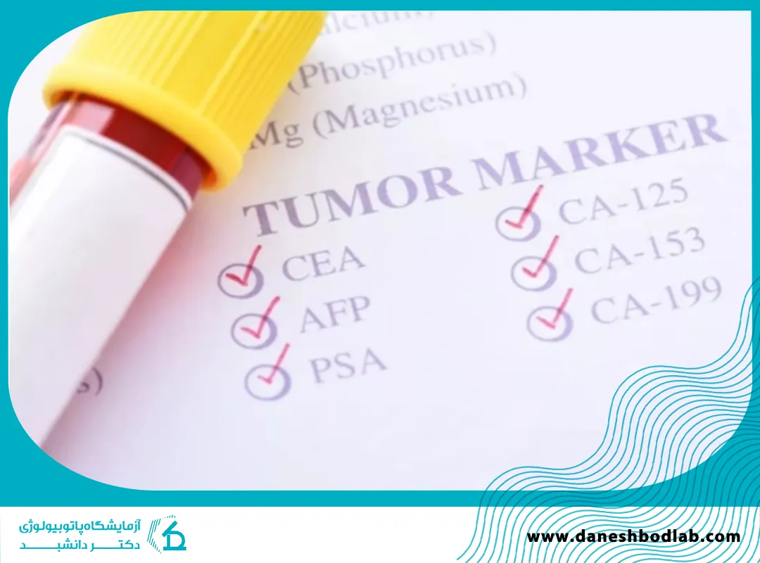 تفسیر آزمایش تومور مارکر